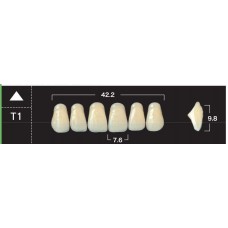 Зубы акриловые двухслойные GLORIA New Ace, фронтальные верхние, фасон Т1