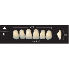 Зубы акриловые двухслойные GLORIA New Ace, фронтальные верхние, фасон Т6