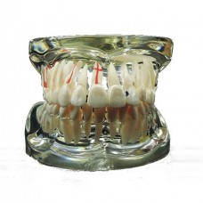 Фантомная челюсть прозрачная с патологией зубов